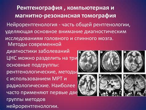 Диагностические методы и подходы в неврологии женских заболеваний