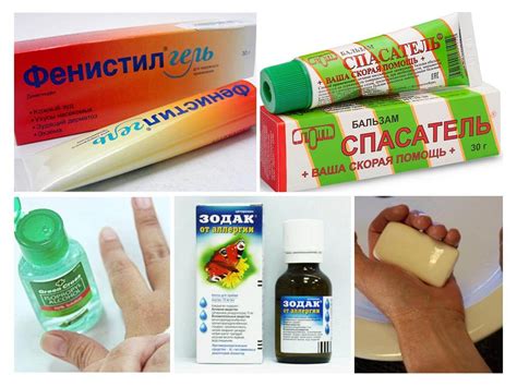 Домашние средства и рецепты для снятия зуда на верхней части головы