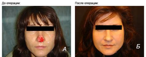 Естественное заживление укуса собаки: подробное описание