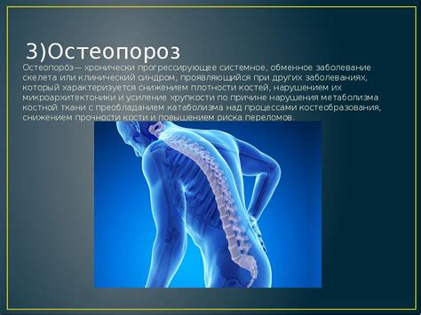 Заболевания позвоночника и опорно-двигательной системы
