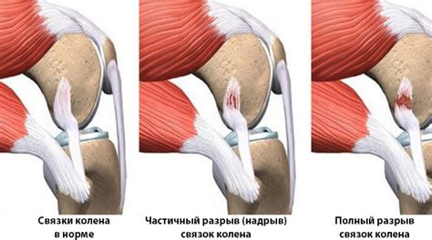 Заболевания суставов и связок
