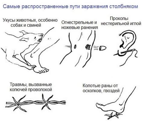 Здоровье на кону: причины высокой опасности столбняка