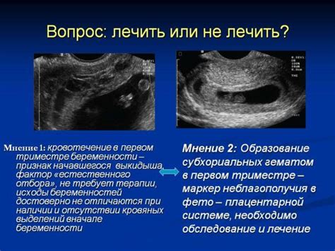 Значение скрининга на ранних этапах беременности