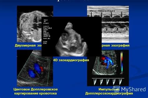 Значимость ультразвукового диагностического метода