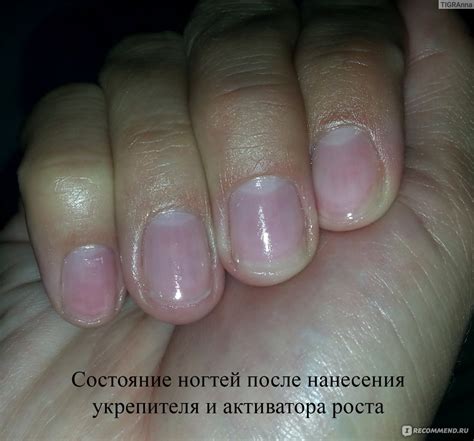 Идеальное состояние ногтей: забота о здоровье и красоте