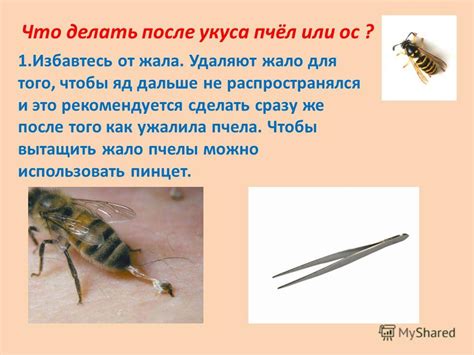 Извлечение жала ос или пчелы: правила и безопасные методы