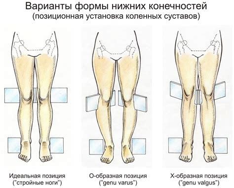 Изучите результаты осмотра ног и стоп