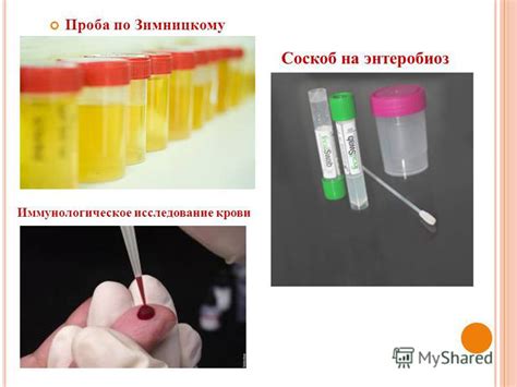 Иммунологическое исследование крови на антитела