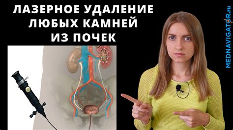 Инновационные подходы к хирургическому удалению камней в мочевом пузыре