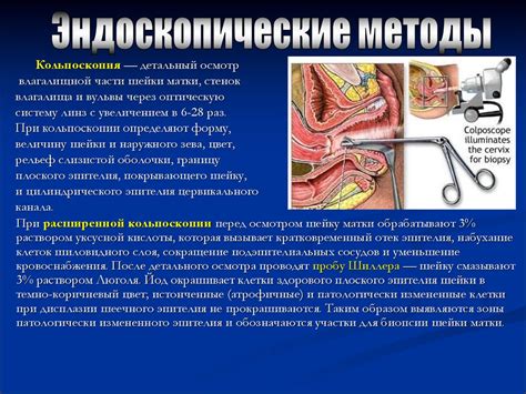 Иновационный метод лечения гинекологических заболеваний с применением Метрогила через капельницу