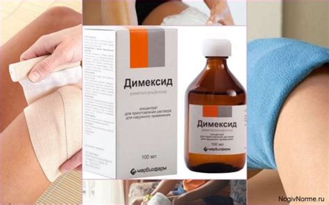 Использование холодовых компрессов