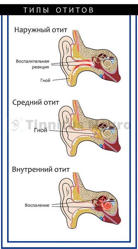 Как диагностировать гной в ушах