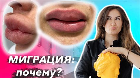Как избежать судороги верхней губы: полезные рекомендации