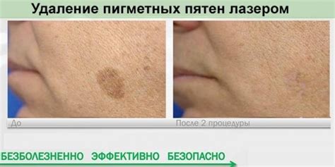 Как обратиться за помощью к эксперту для анализа пигментных пятен на коже