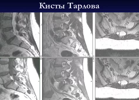 Как определить проблему и возможные осложнения при отсутствии лечения