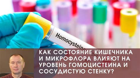 Как повысить уровень гомоцистеина