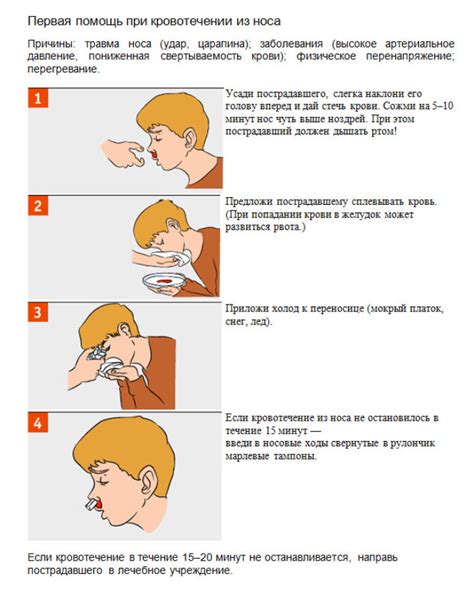 Как прекратить кровотечение из носу: эффективные способы и средства