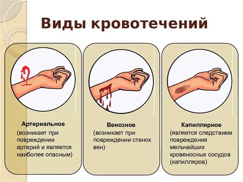 Как распознать серьезное кровотечение от незначительного повреждения