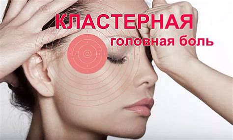 Кластерная головная боль: причины и симптомы