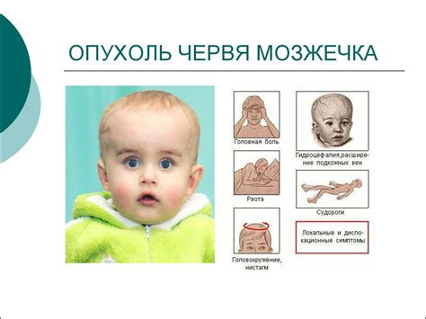 Координационные нарушения и дисбаланс у детей с неполным развитием червя мозжечка