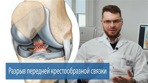 Коррекция состояния колена с помощью компрессионного бинта или коленного корсета