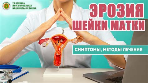 Лечение гладкой шейки матки: методы и рекомендации