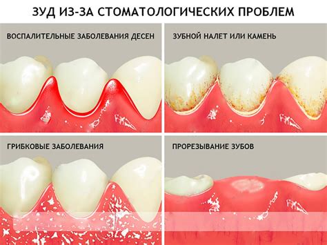 Лечение гноя на деснах в домашних условиях