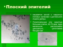 Лечение и профилактика нормализации состояния эпителия в моче