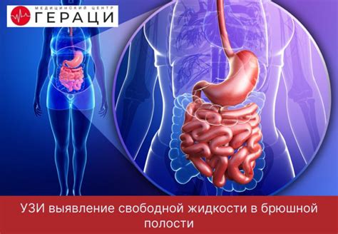 Медикаментозное лечение скопления жидкости в брюшной полости