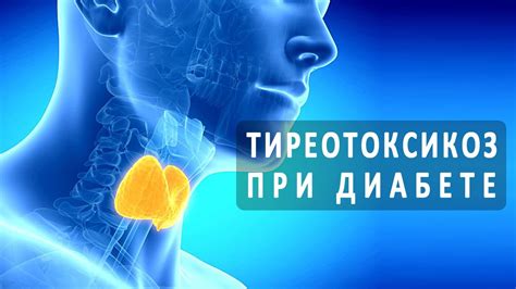 Медицинские проблемы, такие как гипертиреоз или Диабет