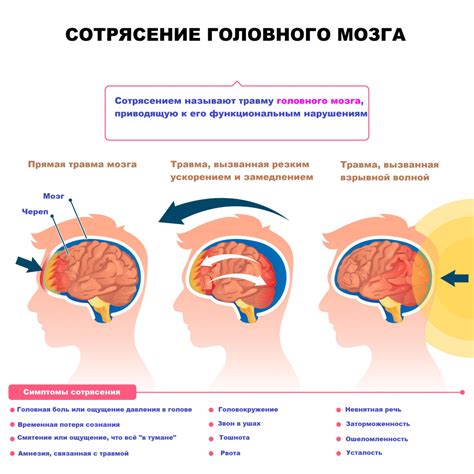 Метеозависимость после перенесенного травматического сотрясения головы у взрослых