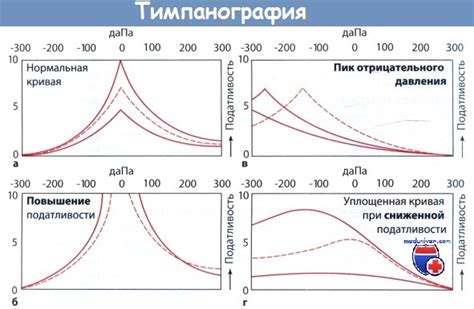 Методика и значимость измерения рефлекса барабанной перепонки тип А