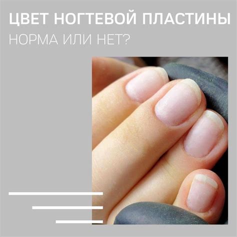 Методы внешнего воздействия при угасании цвета ногтевой пластины