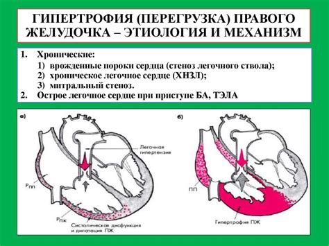 Методы восстановления и реабилитации при выраженных изменениях работы миокарда левого камеры сердца