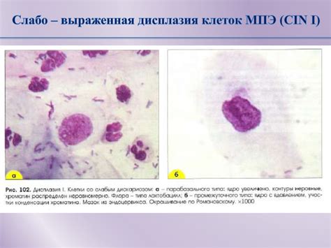 Методы и процедуры для определения и оценки присутствия плоского эпителия в моче