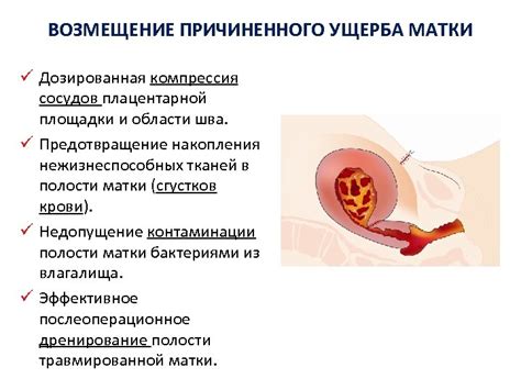 Методы лечения внутреннего кровотечения в полости матки