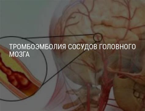 Методы лечения и профилактики головного зуда