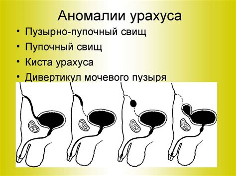 Методы медицинского лечения развязывания пупка у взрослых: основные принципы и процедуры