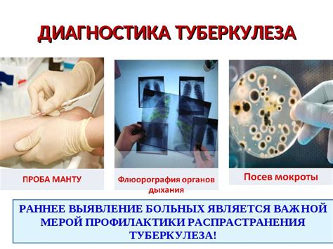 Методы обследования и диагностики для выявления комков в груди