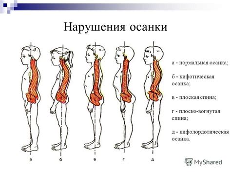 Методы определения нарушений формы и положения шеи у ребенка