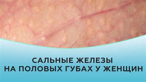 Методы эффективного устранения трещинок на области половых губ