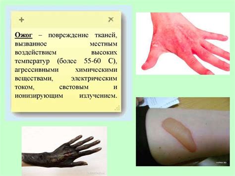 Механизм возникновения ожогов на лице и их классификация