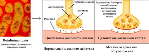 Механизм действия и основные преимущества ботулотоксина