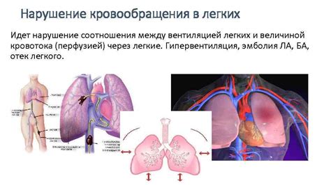 Механизм нарушения кровообращения в области сплетений позвоночного столба