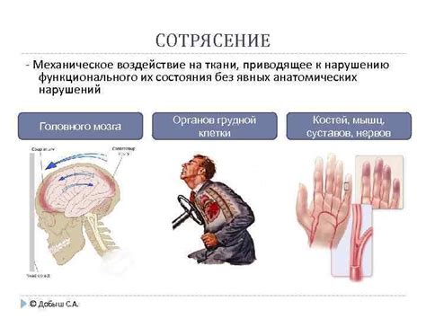 Механическое воздействие: методы для случаев с потерей ключа