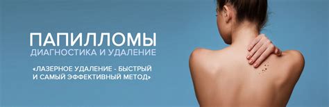 Минимально инвазивные методы уничтожения папиллом: лазер и азот