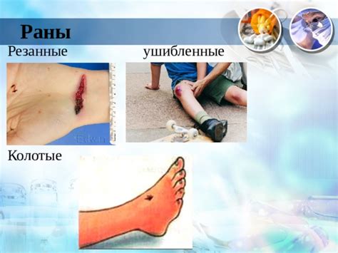 Мифологические соответствия в символике травмирующего действия на руку