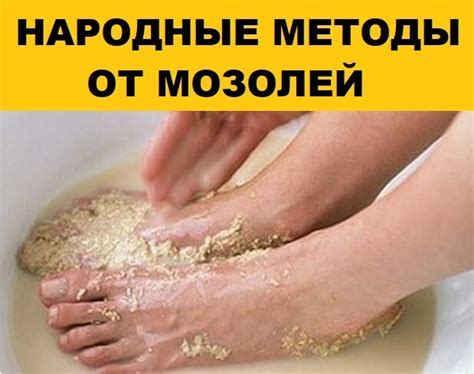 Народные рецепты, способствующие удалению мозолей