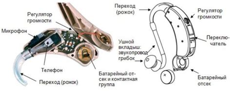 Нарушение работы слухового аппарата