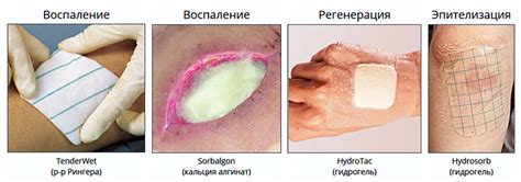 Натуральные способы лечения ран: новые подходы без химии